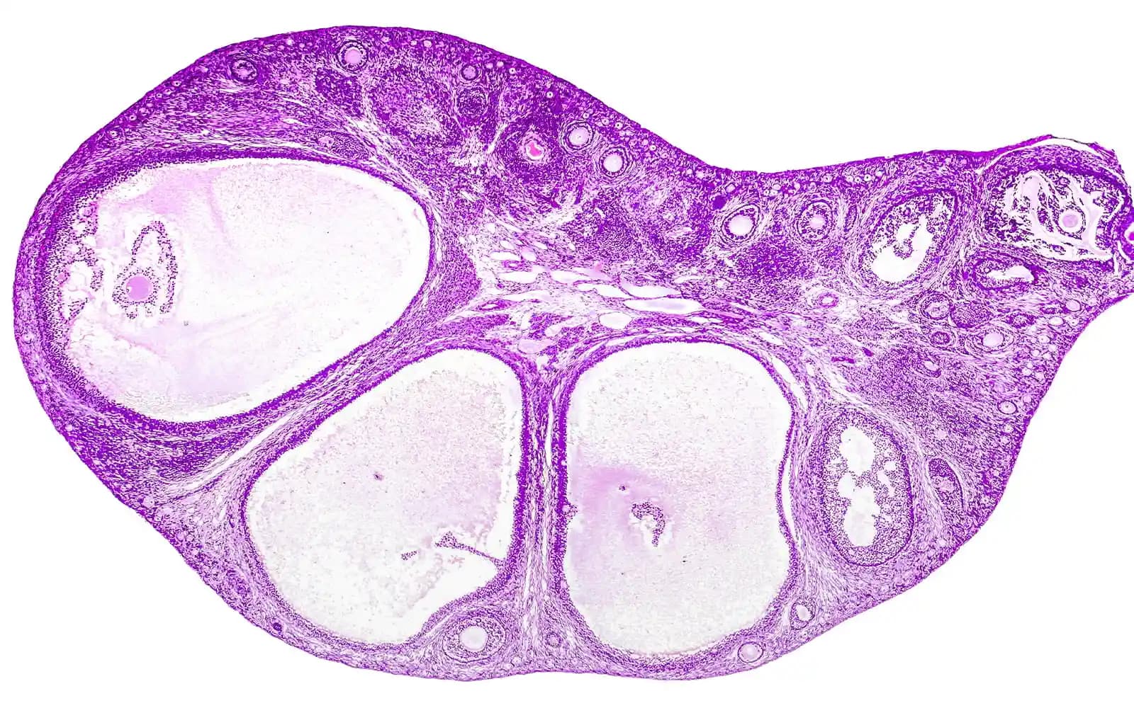 eggs follicles